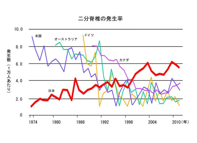 二分脊椎の発生率